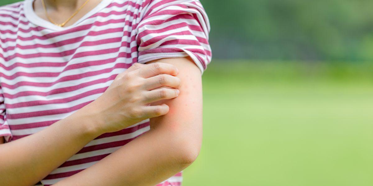 چه لباس‌هایی بدن را میخورد؟ + معرفی راهکارهایی برای رفع آن